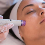 tratamiento facial Centro estético Laura Olcina