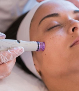 tratamiento facial Centro estético Laura Olcina